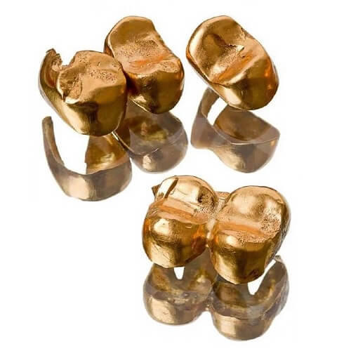 Скупка зубного (стоматологического) золота